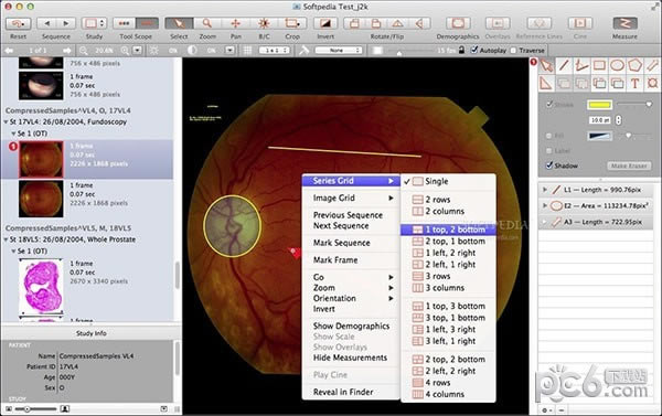 Escape Medical Viewer for Mac