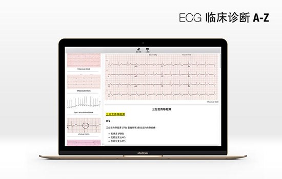 ECG Mac