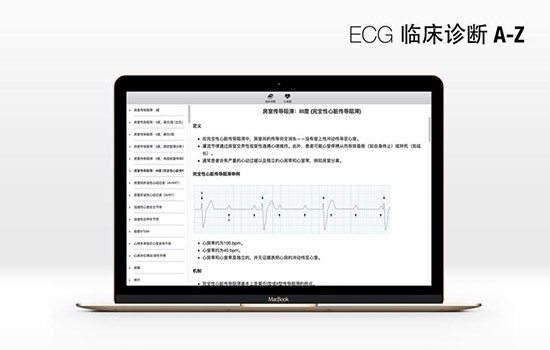 ECG for Mac