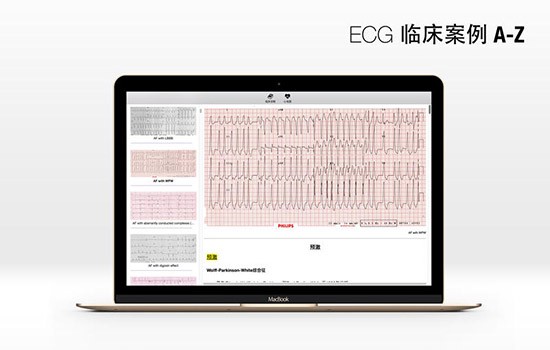 ECG Mac